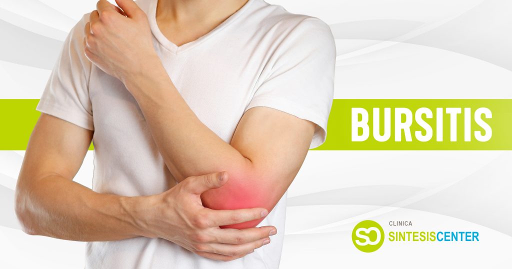 Bursitis; Síntomas Y Tratamiento | Clínica Síntesis Center