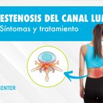 Qué es la estenosis del canal lumbar? Síntomas y tratamiento